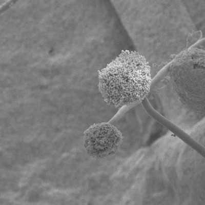 Test could detect patients at risk from lethal fungal spores