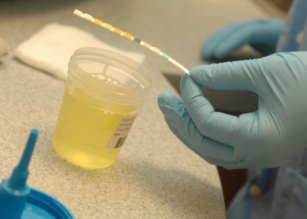 Urine testing