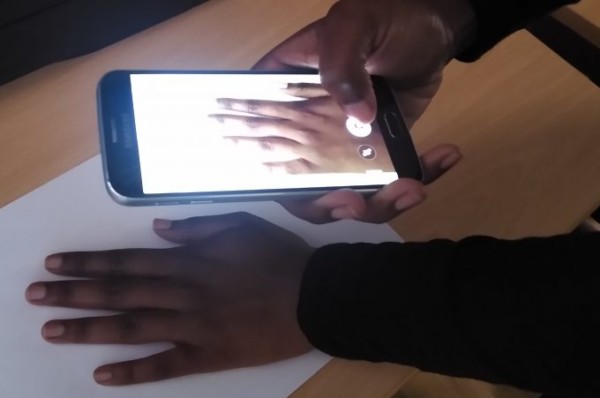 Scleroderma phone app. Patient using their smartphone to take a photo of their hand and ulcers
