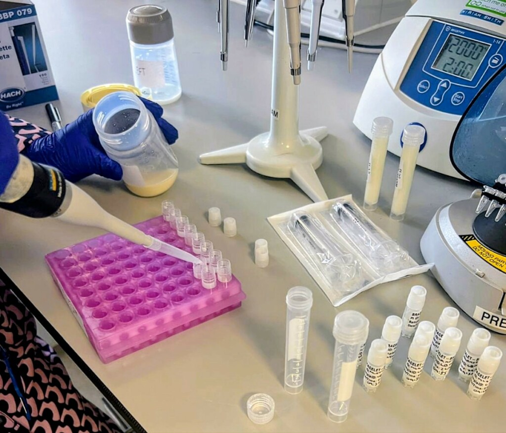 Collecting samples of breast milk